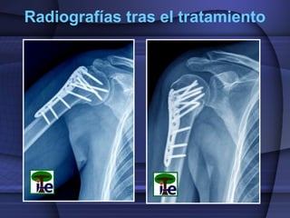 Radiografías tras el tratamiento

 