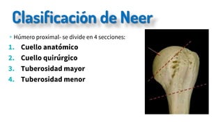 Clasificación de Neer
▹Húmero proximal- se divide en 4 secciones:
1. Cuello anatómico
2. Cuello quirúrgico
3. Tuberosidad mayor
4. Tuberosidad menor
 