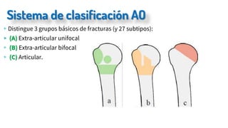 Sistema de clasificación AO
▹Distingue 3 grupos básicos de fracturas (y 27 subtipos):
▹ (A) Extra-articular unifocal
▹ (B) Extra-articular bifocal
▹ (C) Articular.
 