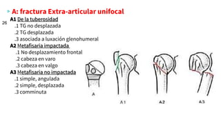 ▹A: fractura Extra-articular unifocal
A1 De la tuberosidad
.1 TG no desplazada
.2 TG desplazada
.3 asociada a luxación glenohumeral
A2 Metafisaria impactada
.1 No desplazamiento frontal
.2 cabeza en varo
.3 cabeza en valgo
A3 Metafisaria no impactada
.1 simple, angulada
.2 simple, desplazada
.3 comminuta
26
 