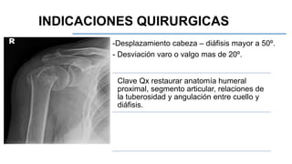-Desplazamiento cabeza – diáfisis mayor a 50º.
- Desviación varo o valgo mas de 20º.
Clave Qx restaurar anatomía humeral
proximal, segmento articular, relaciones de
la tuberosidad y angulación entre cuello y
diáfisis.
INDICACIONES QUIRURGICAS
 