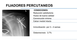 CONDICIONES:
Reducción satisfactoria
Hueso de buena calidad
Conminución mínima
Calcar medial intacto
Inmovilización por 3 – 4 semas
Osteonecrosis 3.7%
FIJADORES PERCUTANEOS
 
