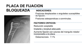 INDICACIONES:
Fracturas desplazadas o anguladas susceptibles
de fijación.
Fracturas osteoporoticas o conminutas.
FACTORES CRITICOS:
Reducción aceptable
Implante y longitud adecuado
Aumento fijación con suturas del manguito rotador
incorporados a la placa
Osteonecrosis 7.1%
PLACA DE FIJACION
BLOQUEADA
 
