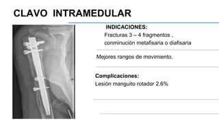 INDICACIONES:
Fracturas 3 – 4 fragmentos ,
conminución metafisaria o diafisaria
Mejores rangos de movimiento.
Complicaciones:
Lesión manguito rotador 2.6%
CLAVO INTRAMEDULAR
 