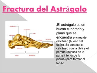 Fractura del Astrágalo
El astrágalo es un
hueso cuadrado y
plano que se
encuentra encima del
calcáneo (hueso del
talón). Se conecta el
calcáneo con la tibia y el
peroné (huesos en la
parte inferior de la
pierna) para formar el
tobillo.
 