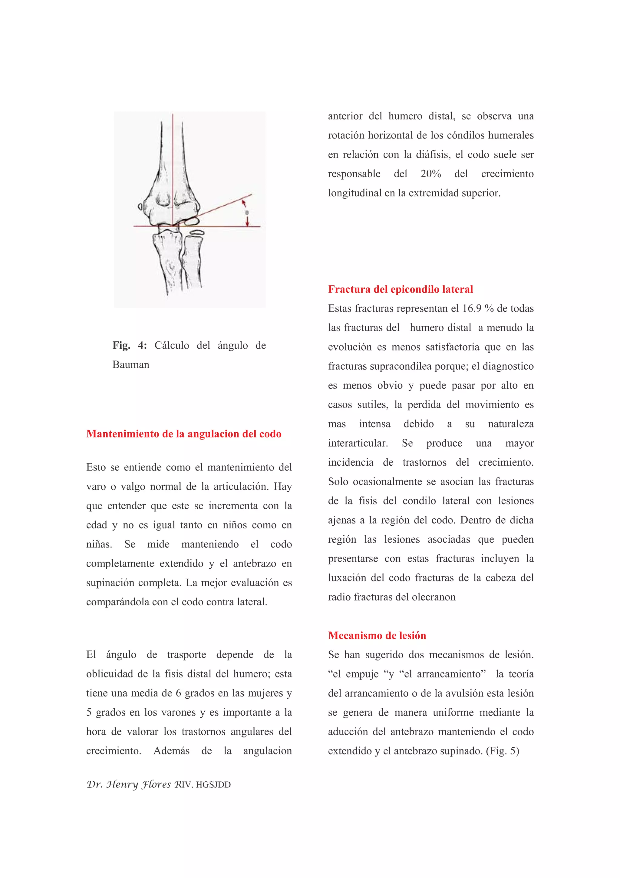 Fractura Del Condilo Humeral | PDF