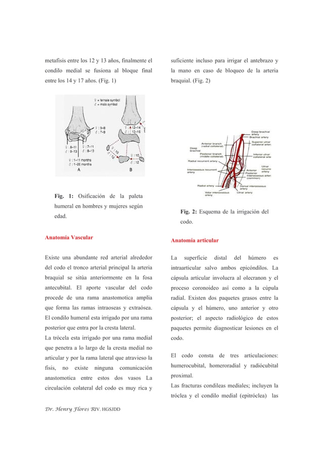 Fractura Del Condilo Humeral | PDF