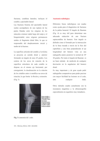 Fractura Del Condilo Humeral | PDF