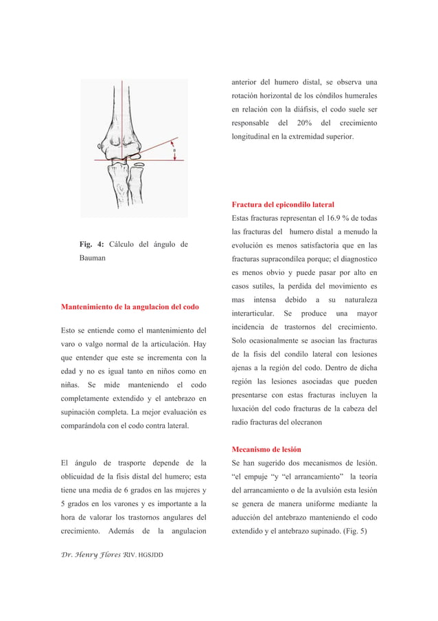 Fractura Del Condilo Humeral | PDF