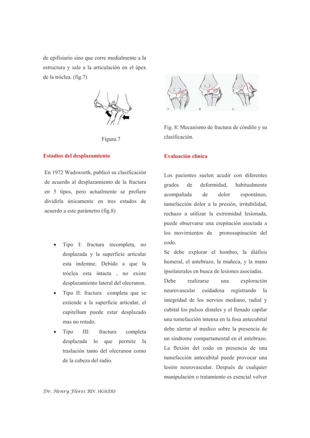 Fractura Del Condilo Humeral | PDF