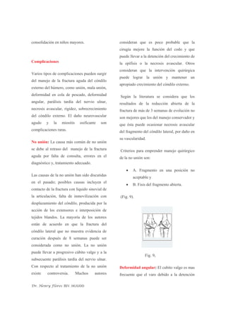 Fractura Del Condilo Humeral | PDF