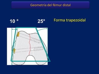 Forma trapezoidal10 ° 25°
 