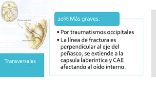 Transversales
•Por traumatismos occipitales
• La línea de fractura es
perpendicular al eje del
peñasco, se extiende a la
capsula laberíntica y CAE
afectando al oído interno.
20% Más graves.
 