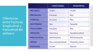 Diferencias
entre fracturas
longitudinal y
transversal del
peñasco
 
