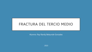 FRACTURA DEL TERCIO MEDIO
Alumno: Ray Randy Belaunde Gonzales
2023
 