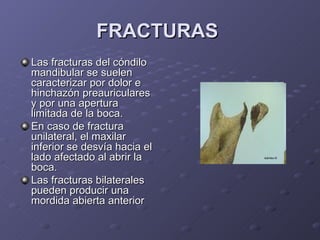 FRACTURAS   Las fracturas del cóndilo mandibular se suelen caracterizar por dolor e hinchazón preauriculares y por una apertura limitada de la boca.  En caso de fractura unilateral, el maxilar inferior se desvía hacia el lado afectado al abrir la boca.  Las fracturas bilaterales pueden producir una mordida abierta anterior   