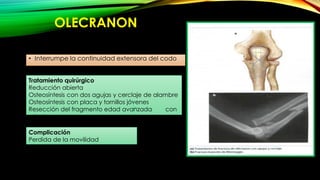 FRACTURAS DE MIEMBROS SUPERIOR CLASIFICACI N MECANISMO DE 