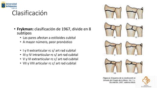 Clasificación
• Frykman: clasificación de 1967, divide en 8
subtipos
• Las pares afectan a estiloides cubital
• A mayor número, peor pronóstico
• I y II extrarticular rc s/ art rad cubital
• III y IV intrarticular rc s/ art rad cubital
• V y VI extrarticular rc c/ art rad cubital
• VII y VIII articular rc c/ art rad cubital
 
