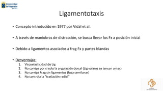 Ligamentotaxis
• Concepto introducido en 1977 por Vidal et al.
• A través de maniobras de distracción, se busca llevar los Fx a posición inicial
• Debido a ligamentos asociados a frag Fx y partes blandas
• Desventajas:
1. Viscoelasticidad de Lig
2. No corrige por si solo la angulación dorsal (Lig volares se tensan antes)
3. No corrige Frag sin ligamentos (fosa semilunar)
4. No controla la “traslación radial”
 