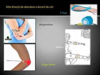 Acupunctura
Trigger Points
KTape
Reflexo
 