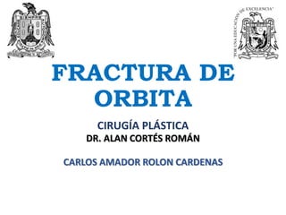 FRACTURA DE
ORBITA
CIRUGÍA PLÁSTICA
DR. ALAN CORTÉS ROMÁN
CARLOS AMADOR ROLON CARDENAS
 