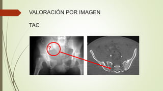 VALORACIÓN POR IMAGEN
TAC
?
 