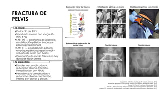 FRACTURA DE
PELVIS
Evaluación inicial del trauma Estabilización pélvica con manta Estabilización pélvica con cinturón
Valoración de colocación de
sonda Foley Fijación interna Fijación interna
•Protocolo de ATLS
•Transfusión masiva con sangre O-
mín. 4 PG
•FAST (+) → celiotomía de urgencia,
estabilización pélvica, empaque
pélvico preperitoneal
•FAST (-) → estabilización pélvica,
empaque pélvico preperitoneal y
oclusión de aorta con balón
•Colocación de sonda Foley si no hay
datos de lesión uretral
Tx inicial
•Estables no complicadas→
reducción abierta, tracción,
inmovilización con férula
•Inestables y/o complicadas→
reducción abierta con fijación
interna con clavos y placas
Tx específico
Grupo CTO. CTO Traumatología 3ª edición. México. 2018.
Brinker MR. Review of Orthopedic Trauma 2nd edition. Wolters Kluwers. 2013.
Russell GV. Pelvic Fractures. Medscape 2018.
Fiechtl J. Pelvic Trauma: Initial evaluation and management. Uptodate. 2019.
Burlew CC, Moore EE. Severe pelvic fracture in the adult trauma patient. Uptodate. 2019.
 