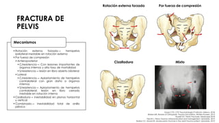 FRACTURA DE
PELVIS
Rotación externa forzada Por fuerza de compresión
Cizalladura Mixto
•Rotación externa forzada→ hemipelvis
ipsilateral inestable en rotación externa
•Por fuerza de compresión
•Anteroposterior
•C/resistencia→ Con lesiones importantes de
órganos internos y alta tasa de mortalidad
•S/resistencia→ lesión en libro abierto bilateral
•Lateral
•C/resistencia→ Aplastamiento de hemipelvis
contralateral con gran daño a órganos
internos
•S/resistencia→ Aplastamiento de hemipelvis
contralateral; lesión en libro cerrado
inestable en rotación interna
•Cizalladura→ inestabilidad en planos horizontal
y vertical
•Combinado→ Inestabilidad total de anillo
pélvico
Mecanismos
Grupo CTO. CTO Traumatología 3ª edición. México. 2018.
Brinker MR. Review of Orthopedic Trauma 2nd edition. Wolters Kluwers. 2013.
Russell GV. Pelvic Fractures. Medscape 2018.
Fiechtl J. Pelvic Trauma: Initial evaluation and management. Uptodate. 2019.
Burlew CC, Moore EE. Severe pelvic fracture in the adult trauma patient. Uptodate. 2019.
 