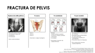 FRACTURA DE PELVIS
•Rotación externa forzada
•Compresión lateral /AP
•Cizalladura
•Combinado
•Alta morbimortalidad
Ruptura de anillo pélvico
•Zona 1
•Zona 2
•Zona 3
•Asociado a vejiga neurógena
Fx sacra
•Simples
•Pared anterior/ posterior
•Columna anterior/ posterior
•Transversa
•Complejas
•Asociadas a luxación de
cabeza femoral
Fx acetabular
•De espina iliaca anterosuperior
(m. sartorio)
•De espina iliaca anteroinferior
(m. recto femoral)
•Tuberosidad isquiática (m.
isquiotibiales)
•Trocanter menor (m. iliopsoas)
•Por contracción muscular
forzada repentina
Fx por avulsión
Grupo CTO. CTO Traumatología 3ª edición. México. 2018.
Brinker MR. Review of Orthopedic Trauma 2nd edition. Wolters Kluwers. 2013.
Russell GV. Pelvic Fractures. Medscape 2018.
Fiechtl J. Pelvic Trauma: Initial evaluation and management. Uptodate. 2019.
Burlew CC, Moore EE. Severe pelvic fracture in the adult trauma patient. Uptodate. 2019.
 
