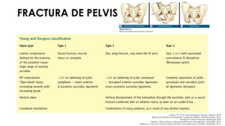 FRACTURA DE PELVIS
Grupo CTO. CTO Traumatología 3ª edición. México. 2018.
Brinker MR. Review of Orthopedic Trauma 2nd edition. Wolters Kluwers. 2013.
Russell GV. Pelvic Fractures. Medscape 2018.
Fiechtl J. Pelvic Trauma: Initial evaluation and management. Uptodate. 2019.
Burlew CC, Moore EE. Severe pelvic fracture in the adult trauma patient. Uptodate. 2019.
 