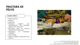 FRACTURA DE
PELVIS
• Dolor inguinal
• Edema
• Equimosis
• Rotación externa con
acortamiento de miembro
pélvico y en aducción
• Dificultad para la marcha
(impotencia funcional)
• Parestesia en miembros
inferiores
• Hemorragia
• Daño a órgano abdominal y/o
pélvico
Cuadro clínico
Grupo CTO. CTO Traumatología 3ª edición. México. 2018.
Brinker MR. Review of Orthopedic Trauma 2nd edition. Wolters Kluwers. 2013.
Russell GV. Pelvic Fractures. Medscape 2018.
Fiechtl J. Pelvic Trauma: Initial evaluation and management. Uptodate. 2019.
Burlew CC, Moore EE. Severe pelvic fracture in the adult trauma patient. Uptodate. 2019.
 