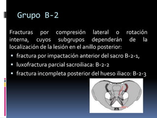 Grupo B-2
Fracturas por compresión lateral o rotación
interna, cuyos subgrupos dependerán de la
localización de la lesión en el anillo posterior:
 fractura por impactación anterior del sacro B-2-1,
 luxofractura parcial sacroiliaca: B-2-2
 fractura incompleta posterior del hueso iliaco: B-2-3

 