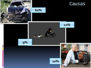 Causas
60%

12%

9%

10%

 