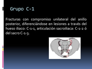 Grupo C-1
Fracturas con compromiso unilateral del anillo
posterior, diferenciándose en lesiones a través del
hueso iliaco: C-1-1, articulación sacroiliaca: C-1-2 ó
del sacro C-1-3.

 