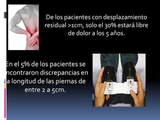 De los pacientes con desplazamiento
residual >1cm, solo el 30% estará libre
de dolor a los 5 años.

En el 5% de los pacientes se
encontraron discrepancias en
la longitud de las piernas de
entre 2 a 5cm.

 