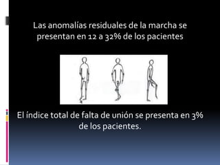Las anomalías residuales de la marcha se
presentan en 12 a 32% de los pacientes

El índice total de falta de unión se presenta en 3%
de los pacientes.

 