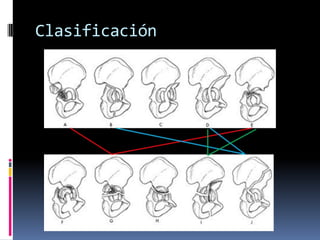 Clasificación

 
