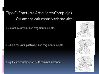 Tipo C: Fracturas Articulares Complejas
C1: ambas columnas variante alta
C1.1Cada columna es un fragmento simple,

C1-2. La columna posteriores un fragmento simple

C1-3. Existe conminución de la columna anterior

 