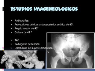 Estudios imageneologicos


Radiografías:



Proyecciones pélvicas anteroposterior cefálico de 40°



Angulo caudal de 40°



Oblicua de 45 °



TAC



Radiografía de tensión:



estabilidad de la pelvis fracturada

 