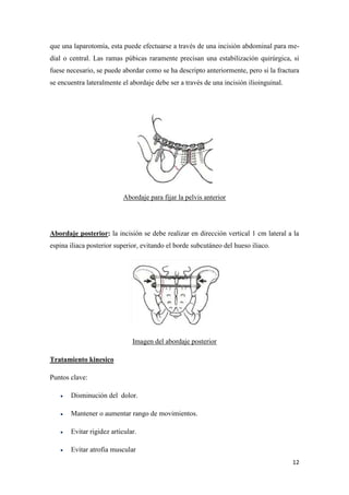 Fractura de pelvis[1]