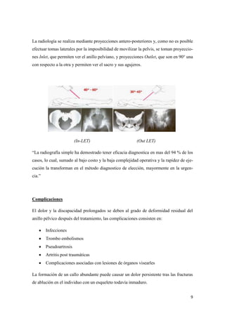 Fractura de pelvis[1]