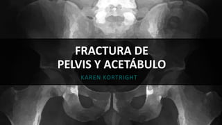 FRACTURA DE
PELVIS Y ACETÁBULO
KAREN KORTRIGHT
 