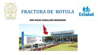 FRACTURA DE ROTULA
MR2 ROJAS CABALLERO BERNARDO
 