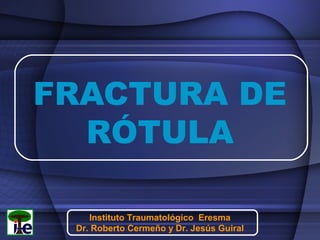 FRACTURA DE
RÓTULA
Instituto Traumatológico Eresma
Dr. Roberto Cermeño y Dr. Jesús Guiral

 