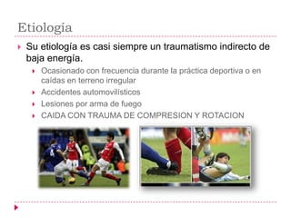 Etiología
   Su etiología es casi siempre un traumatismo indirecto de
    baja energía.
        Ocasionado con frecuencia durante la práctica deportiva o en
         caídas en terreno irregular
        Accidentes automovilísticos
        Lesiones por arma de fuego
        CAIDA CON TRAUMA DE COMPRESION Y ROTACION
 
