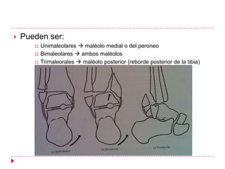    Pueden ser:
          Unimaleolares  maléolo medial o del peroneo
          Bimaleolares  ambos maléolos
          Trimaleorales  maléolo posterior (reborde posterior de la tibia)
 