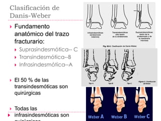 Clasificación de
Danis-Weber
   Fundamento
    anatómico del trazo
    fracturario:
       Suprasindesmótica-- C
       Transindesmótica--B
       Infrasindesmótica--A

   El 50 % de las
    transindesmóticas son
    quirúrgicas

   Todas las
    infrasindesmóticas son
 