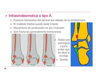    Infrasindesmotica o tipo A
        Fractura transversa del peroné por debajo de la sindesmosis
        El maléolo medial puede estar intacto
        Mecanismo de producción es por inversión
        Son fracturas generalmente transversas.


                                              Todas son
                                               quirúrgica
                                                 s para
                                               evitar que
                                               se abra la
                                                mortaja
                                               Tornillo
 