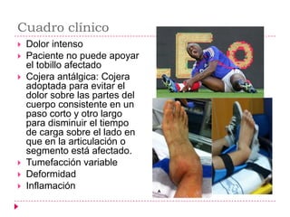 Cuadro clínico
   Dolor intenso
   Paciente no puede apoyar
    el tobillo afectado
   Cojera antálgica: Cojera
    adoptada para evitar el
    dolor sobre las partes del
    cuerpo consistente en un
    paso corto y otro largo
    para disminuir el tiempo
    de carga sobre el lado en
    que en la articulación o
    segmento está afectado.
   Tumefacción variable
   Deformidad
   Inflamación
 