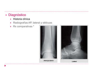    Diagnóstico
        Historia clínica
        Radiografías AP, lateral y oblicuas
        Rx comparativas *
 